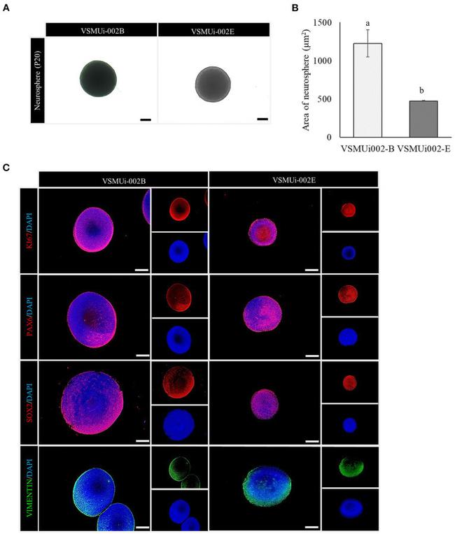 PAX6 Antibody in Immunocytochemistry (ICC/IF)