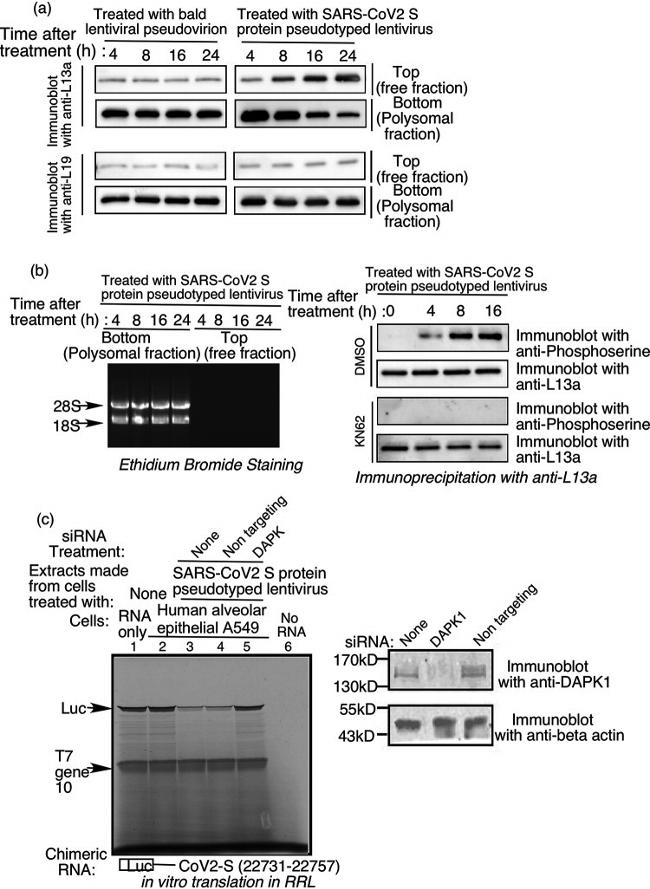 DAPK1 Antibody in Western Blot (WB)