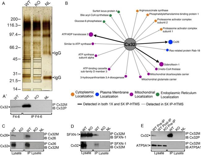 Connexin 26 Antibody in Western Blot, Immunoprecipitation (WB, IP)