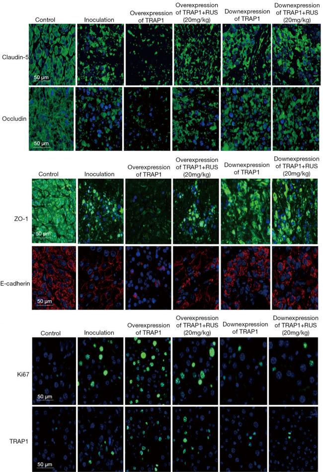 ZO-1 Antibody in Immunohistochemistry (IHC)