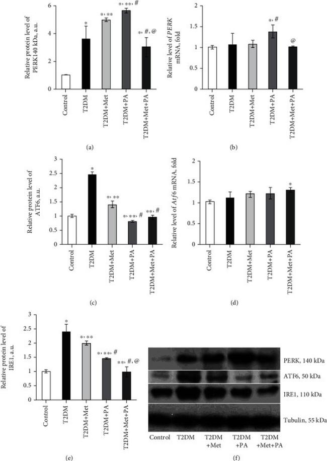 IRE1 alpha Antibody in Western Blot (WB)