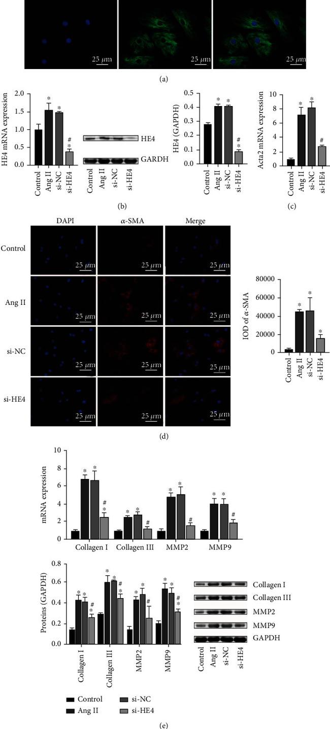 WFDC2 Antibody in Western Blot (WB)