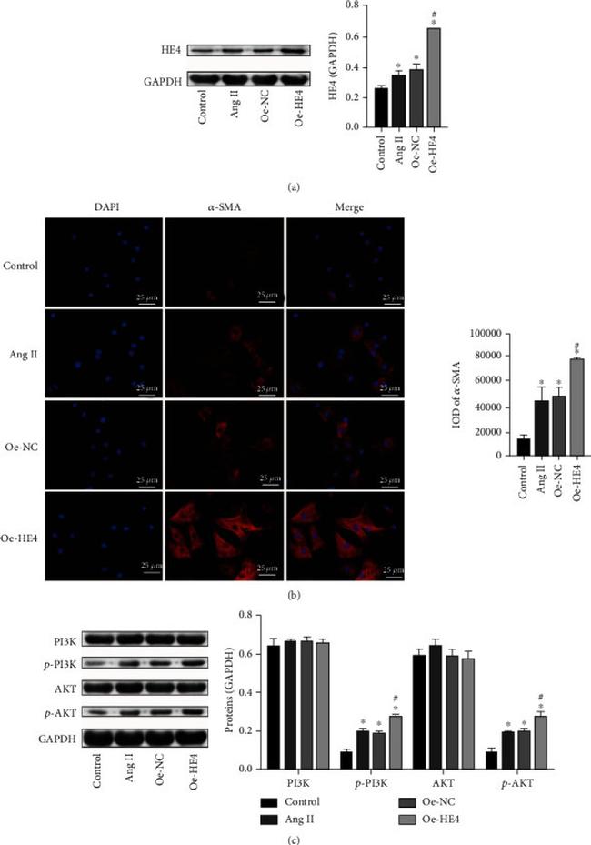 WFDC2 Antibody in Western Blot (WB)