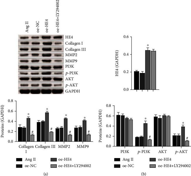 WFDC2 Antibody in Western Blot (WB)