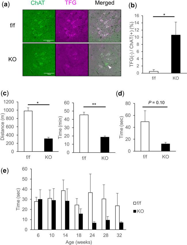 ChAT Antibody in Immunohistochemistry (IHC)