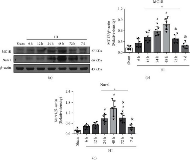 MC1R Antibody in Western Blot (WB)