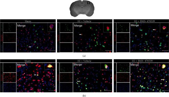 MC1R Antibody in Immunohistochemistry (IHC)