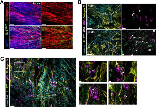 IL-17 A/F Antibody in Immunohistochemistry (IHC)