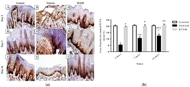 PCNA Antibody in Immunohistochemistry (IHC)