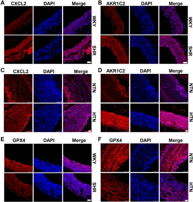 CXCL2 Antibody in Immunohistochemistry (IHC)