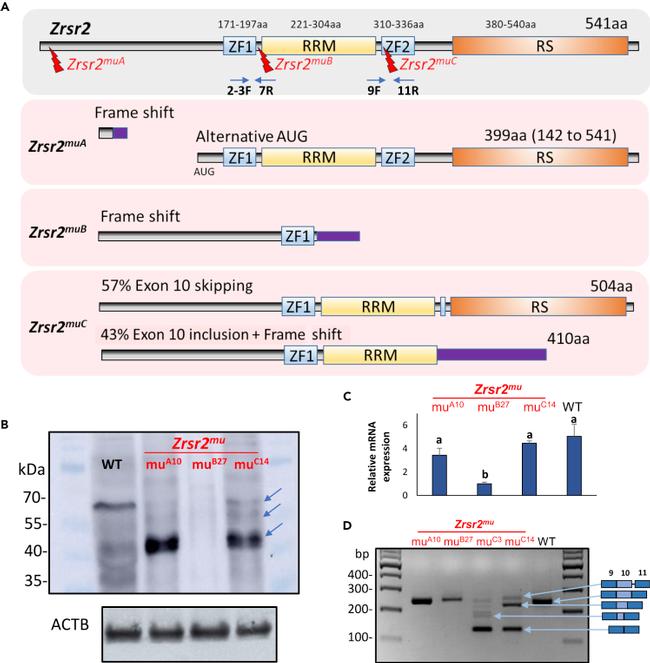 ZRSR2 Antibody in Western Blot (WB)