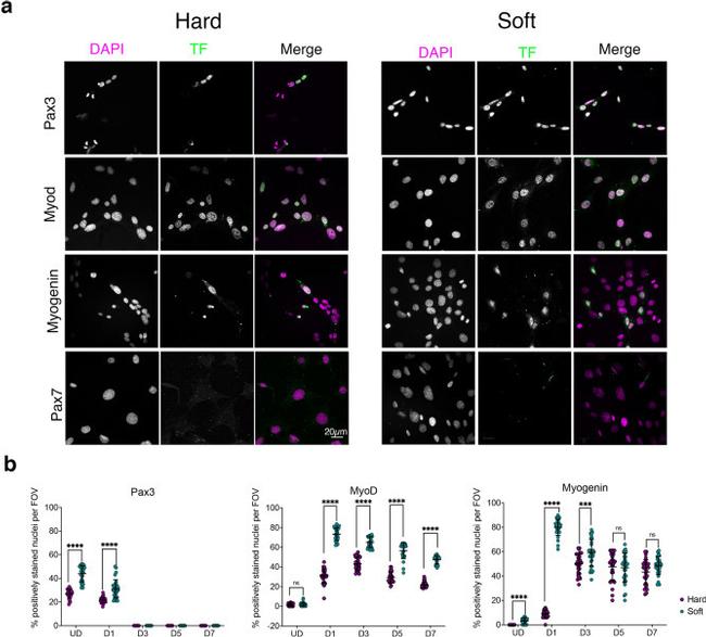 Myogenin Antibody in Immunohistochemistry (IHC)