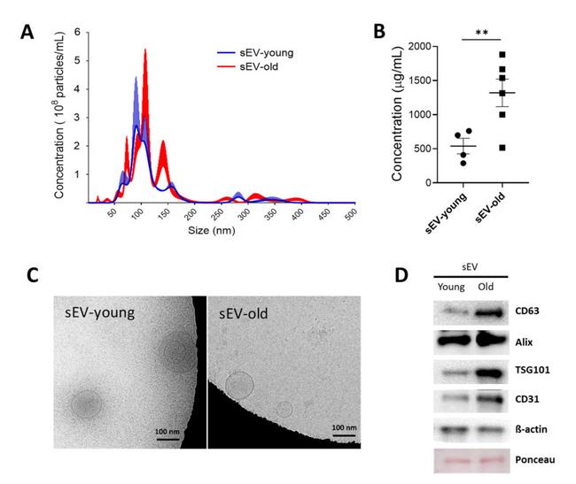 TSG101 Antibody in Western Blot (WB)