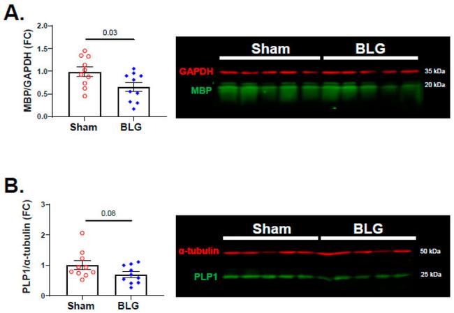 MBP Antibody in Western Blot (WB)