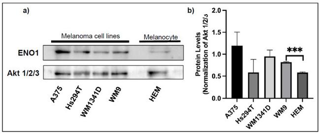 ENO1 Antibody in Western Blot (WB)