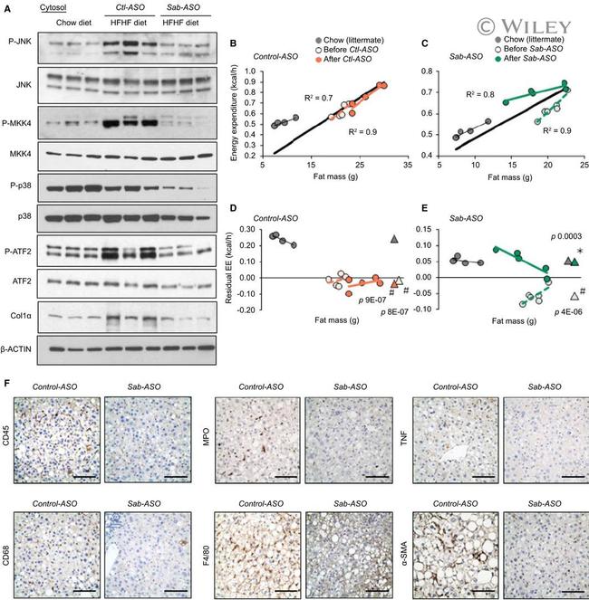 CD45 Antibody in Immunohistochemistry (IHC)