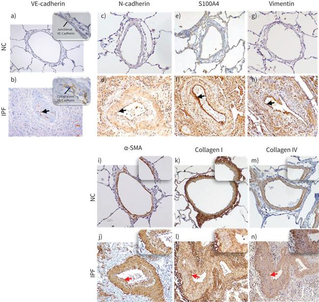 CD144 (VE-cadherin) Antibody in Immunohistochemistry (Paraffin) (IHC (P))