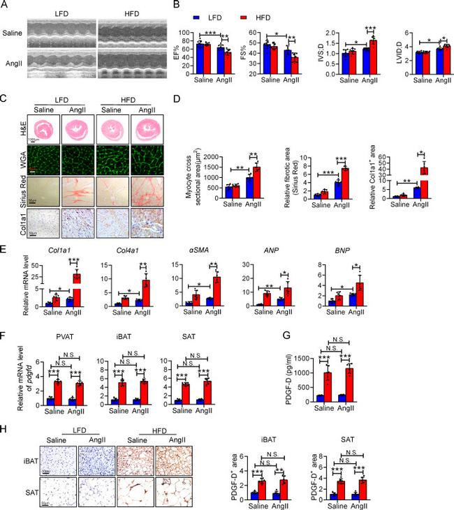 PDGF-D Antibody in Immunohistochemistry (IHC)