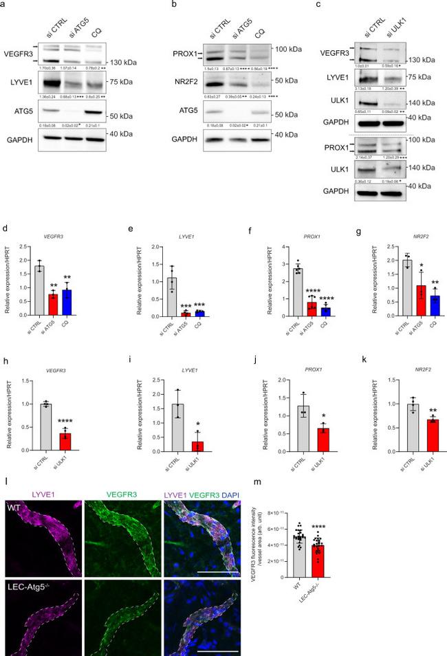 VEGF Receptor 3 Antibody in Immunohistochemistry (IHC)