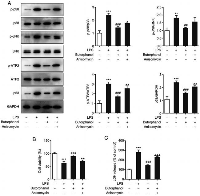 ATF2 Antibody in Western Blot (WB)