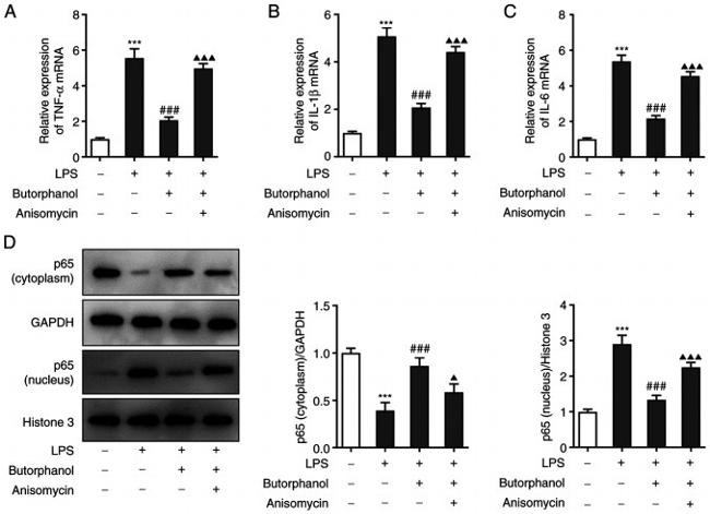 NFkB p65 Antibody in Western Blot (WB)