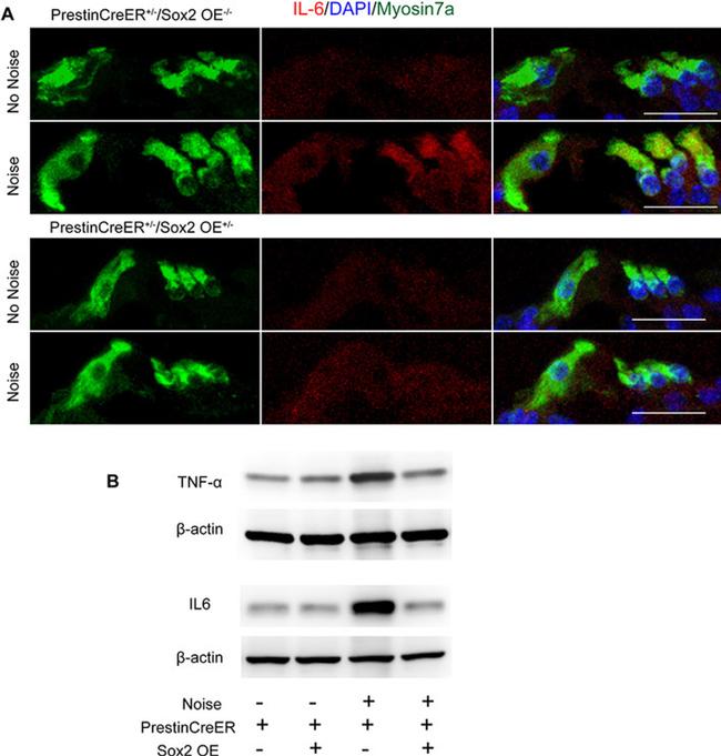 IL-6 Antibody in Immunohistochemistry (IHC)