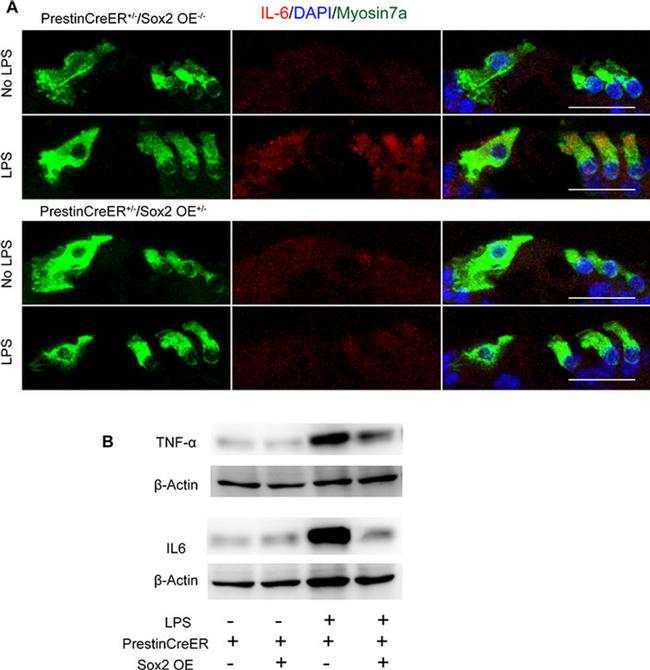 IL-6 Antibody in Western Blot, Immunocytochemistry (WB, ICC/IF)