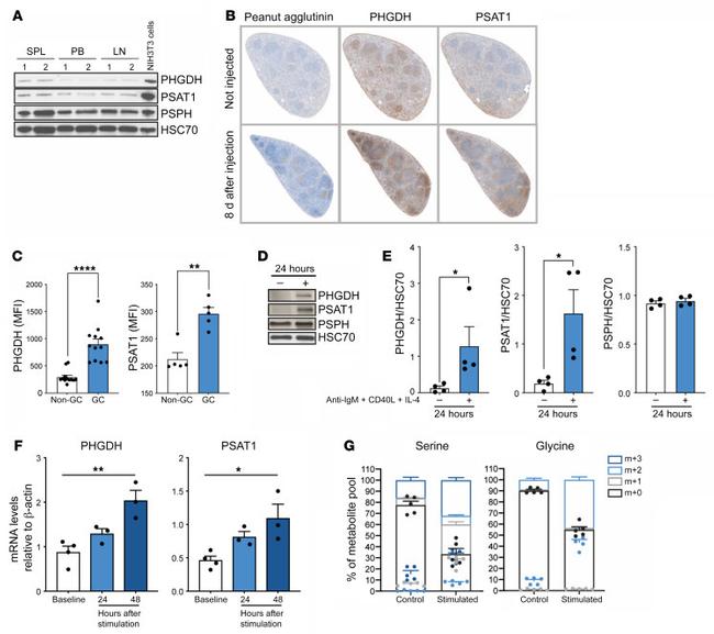 PSAT1 Antibody in Western Blot (WB)