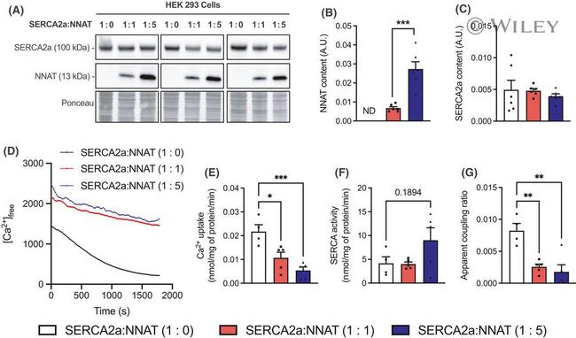 SERCA2 ATPase Antibody in Western Blot (WB)