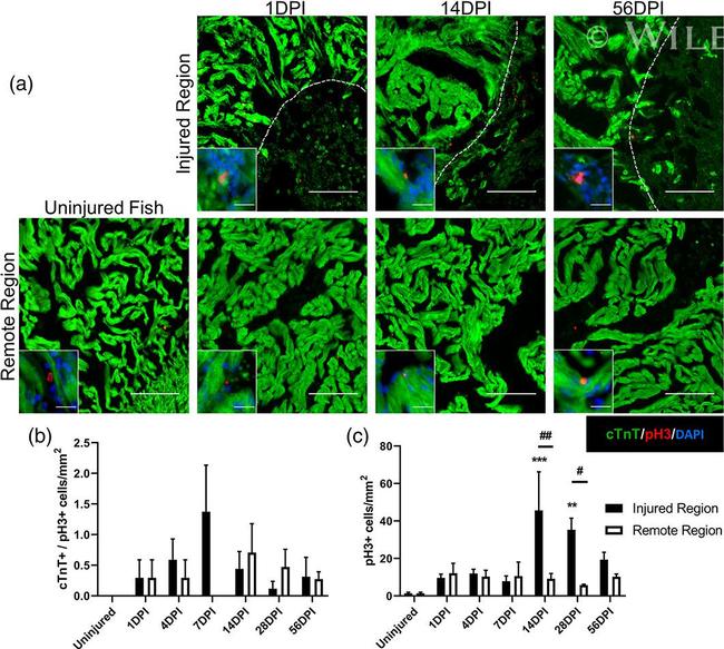 Cardiac Troponin T Antibody in Immunohistochemistry (IHC)