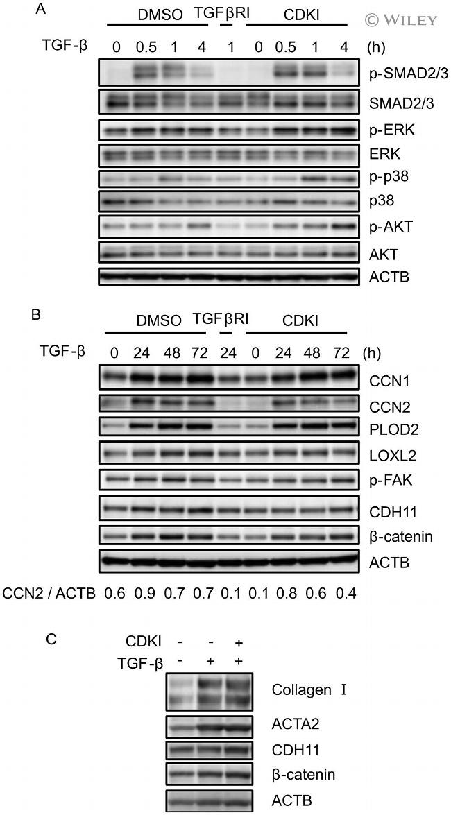 CDH11 Antibody in Western Blot (WB)