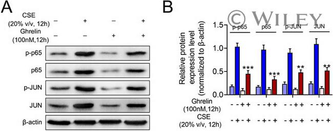 NFkB p65 Antibody in Western Blot (WB)