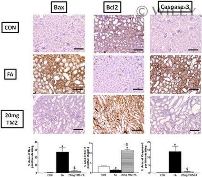 Caspase 3 Antibody in Immunohistochemistry (IHC)