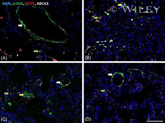 SFTPC Antibody in Immunohistochemistry (IHC)