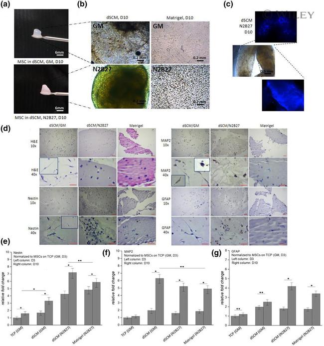 GFAP Antibody in Immunohistochemistry (IHC)