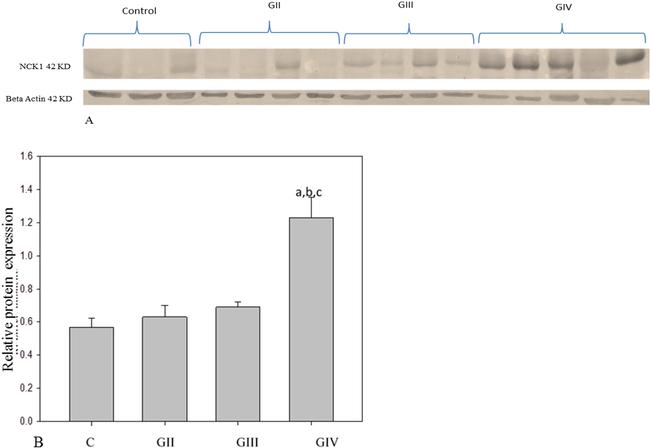 NCK1 Antibody in Western Blot (WB)