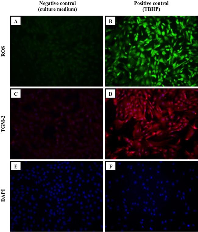 TGM2 Antibody in Immunocytochemistry (ICC/IF)