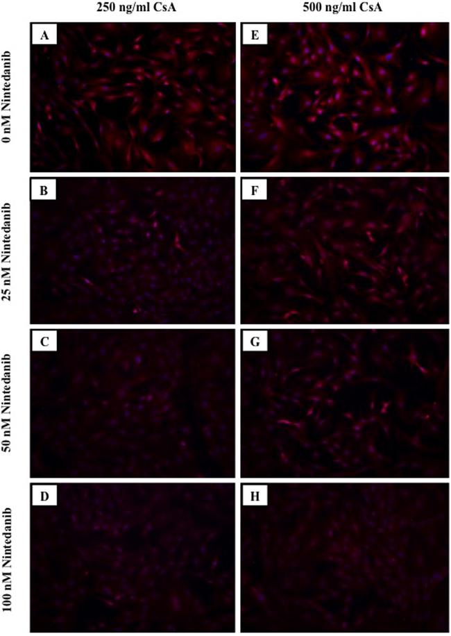 TGM2 Antibody in Immunocytochemistry (ICC/IF)