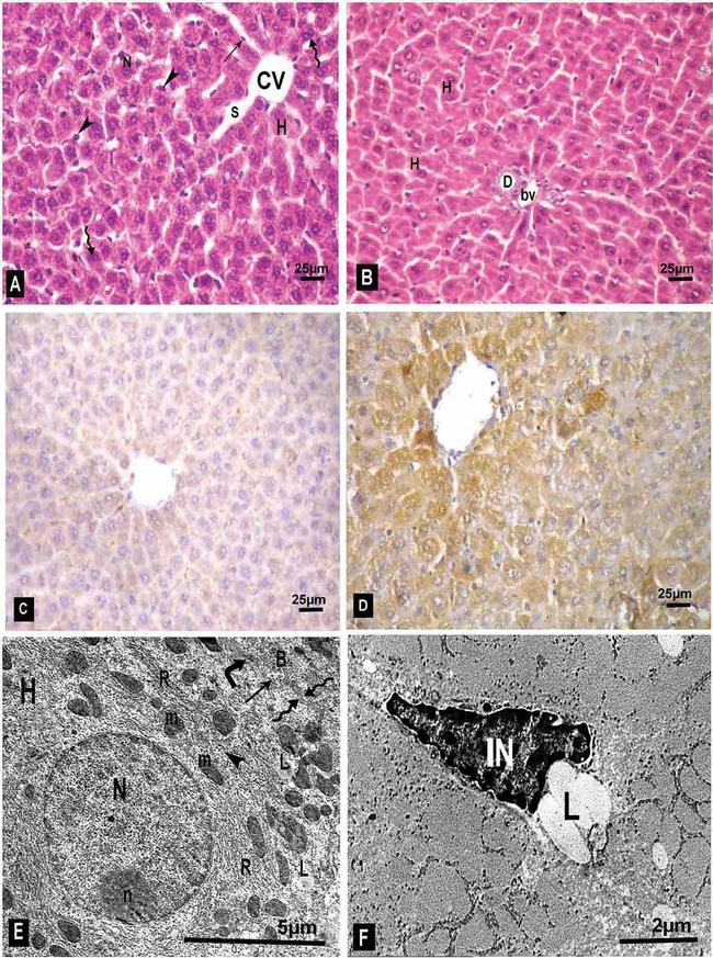 Bcl-2 Antibody in Immunohistochemistry (IHC)