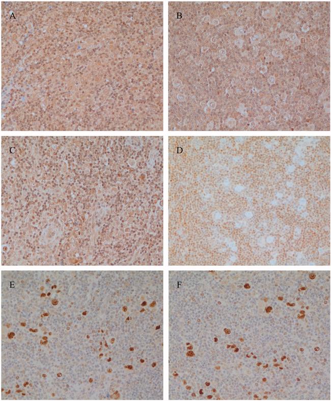 SIRT6 Antibody in Immunohistochemistry (IHC)