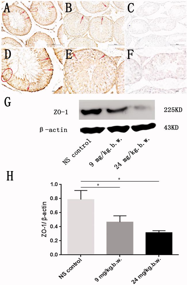 Occludin Antibody in Immunohistochemistry (IHC)