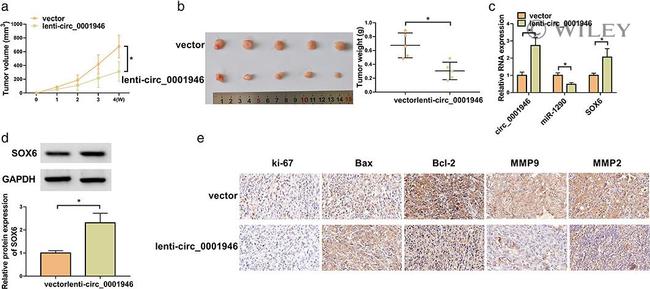 Bcl-2 Antibody in Immunohistochemistry (IHC)