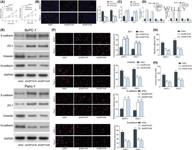 N-cadherin Antibody in Western Blot (WB)