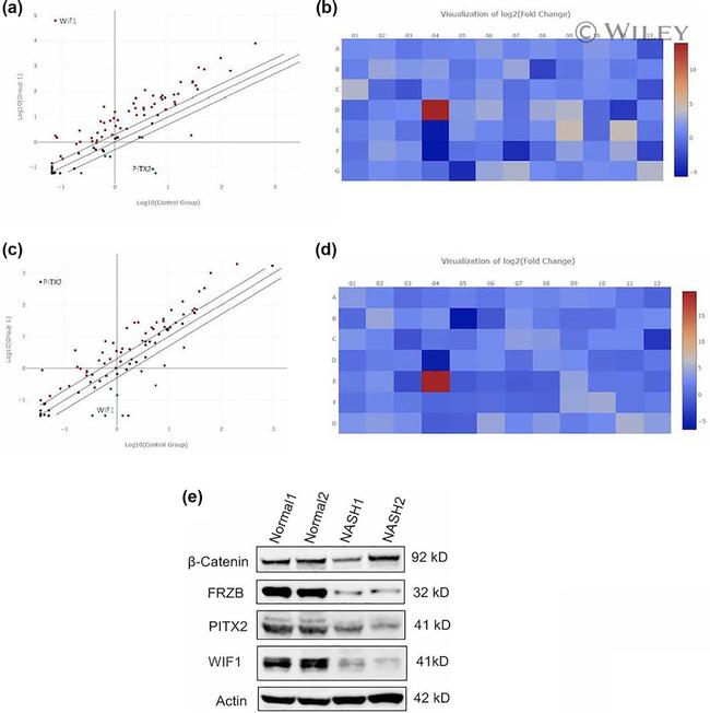 beta Catenin Antibody in Western Blot (WB)