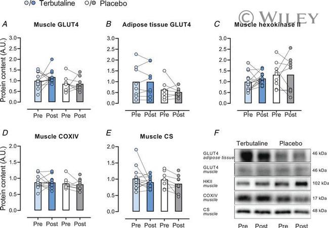 GLUT4 Antibody in Western Blot (WB)