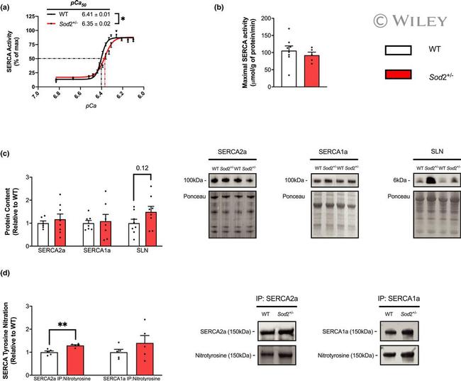 SERCA2 ATPase Antibody in Western Blot (WB)