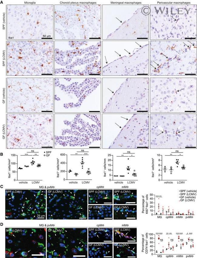 CD74 Antibody in Immunohistochemistry (IHC)