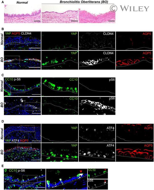 Claudin 4 Antibody in Immunohistochemistry (IHC)