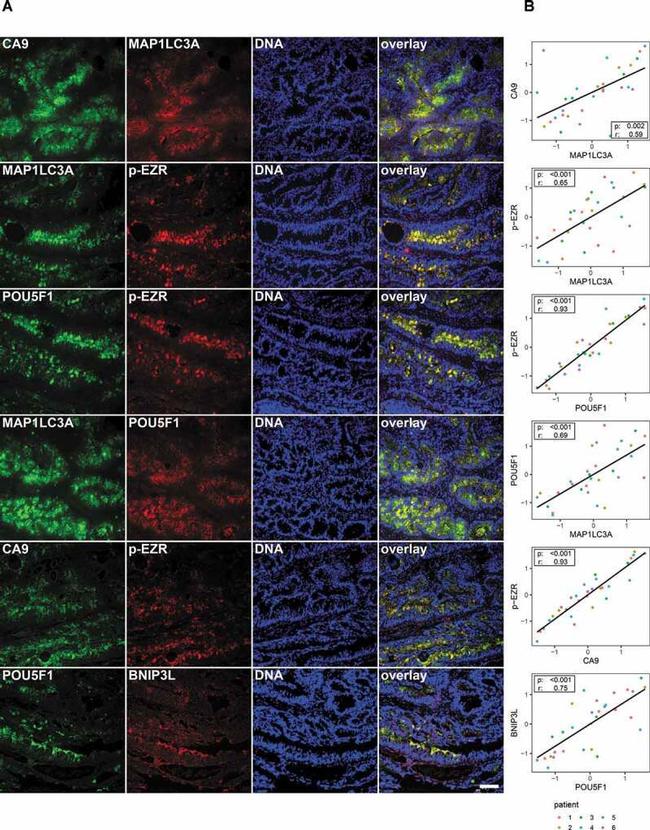 Carbonic Anhydrase IX Antibody in Immunohistochemistry (Frozen) (IHC (F))