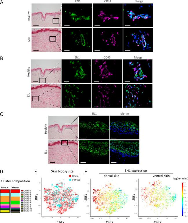 PDI Antibody in Immunohistochemistry (IHC)